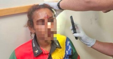 ‘They circled the girls like a shark’: NPA family slams school over alleged horrific attack