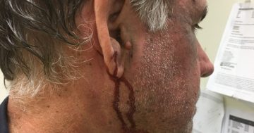 Ergon’s onsite crews battle bites from multiple sources